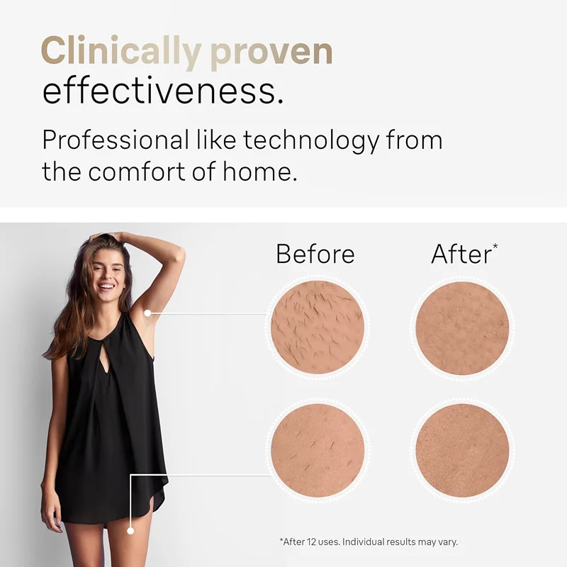 Épilateur laser IPL en continu pour hommes et femmes, machine de découpe de cheveux, lisseurs, rasoir à vibrations, épilateur facial, nouveau – Image 2